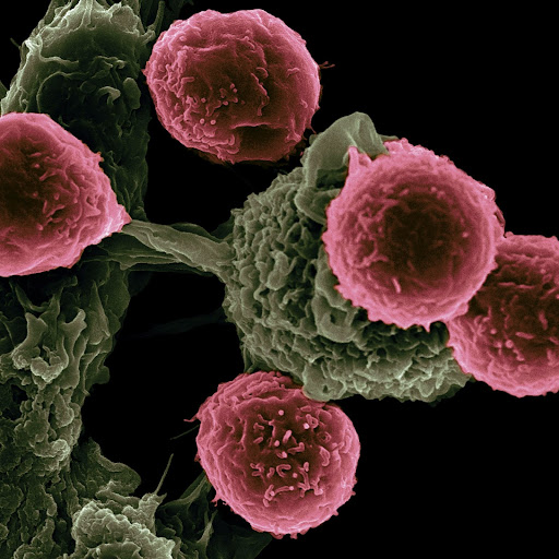 纳米颗粒致人死亡:格林博士的癌症治疗新方法
